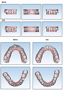 Treatment Plan